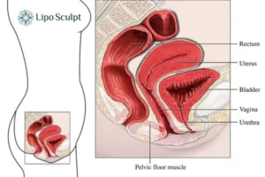 Treatment For A Leaky Bladder 2 How EM Chair treatment Bridgwater can help Leaky bladder issues. Read more now!