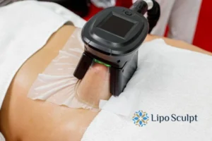 Does Fat Freezing At Home Work? 3 Fat freezing at home from Lipo Sculpt Bridgwater